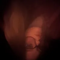 klem_ence